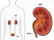 درد کلیه