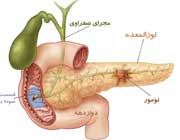 درد لوزالمعده